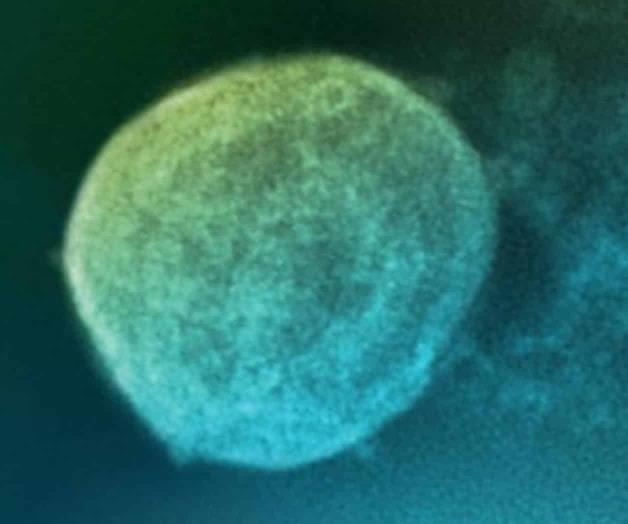 Alertan ahora sobre el ‘Nipah’