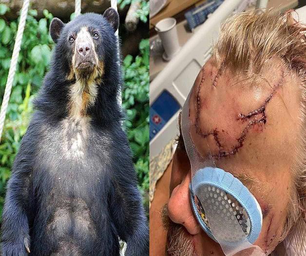 Sobrevive hombre a feroz ataque de oso