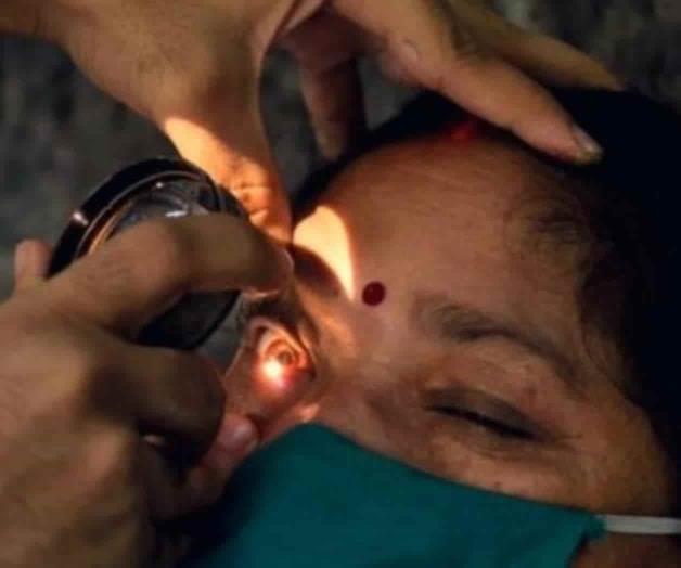 Hay dos casos sospechosos de ‘hongo negro’