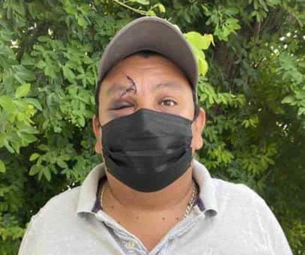 Liberan a agresor Liberan a agresor