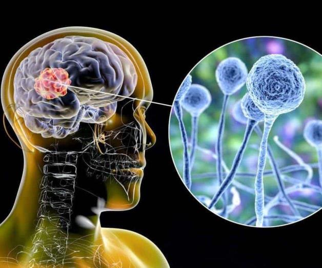 Reynosa sin ‘hongo negro’... hasta ahora Reynosa sin ‘hongo negro’... hasta ahora