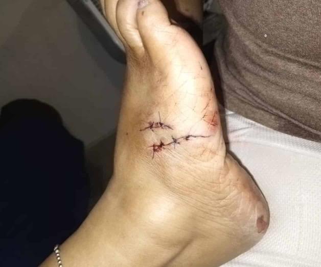 Atacan perros a la población Atacan perros a la población