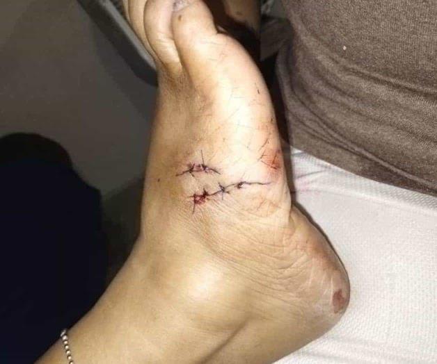 Reportan constantes agresiones de perros en Misiones del Puente Reportan constantes agresiones de perros en Misiones del Puente