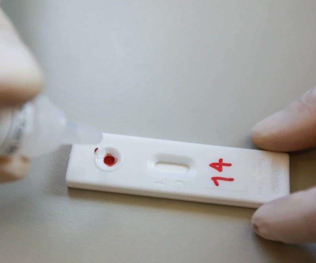 Advierte OMS que VIH aumenta riesgo de Covid-19 Advierte OMS que VIH aumenta riesgo de Covid-19