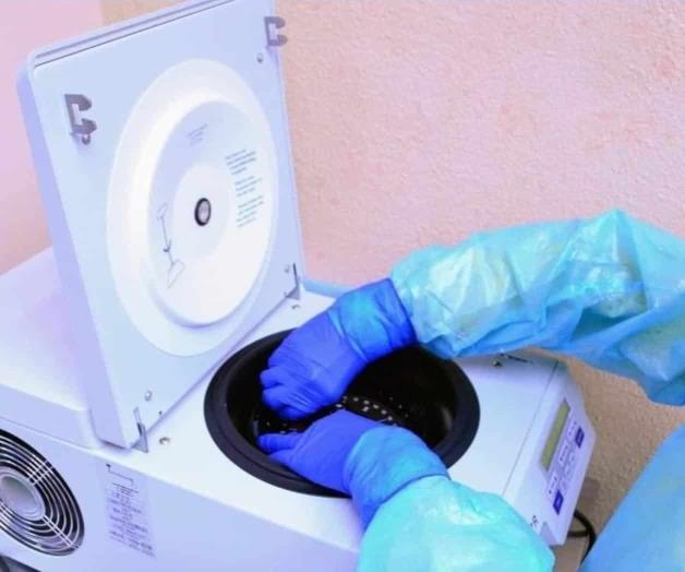 Pega duro el Covid-19