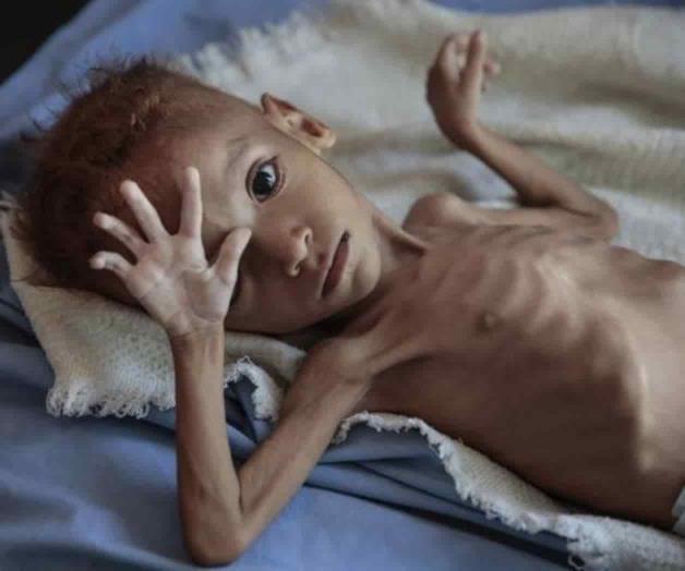 Yemen: Usan privación de alimentos como arma de guerra