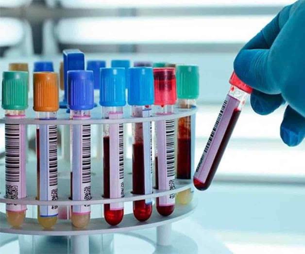 No indican pruebas que hacen del virus