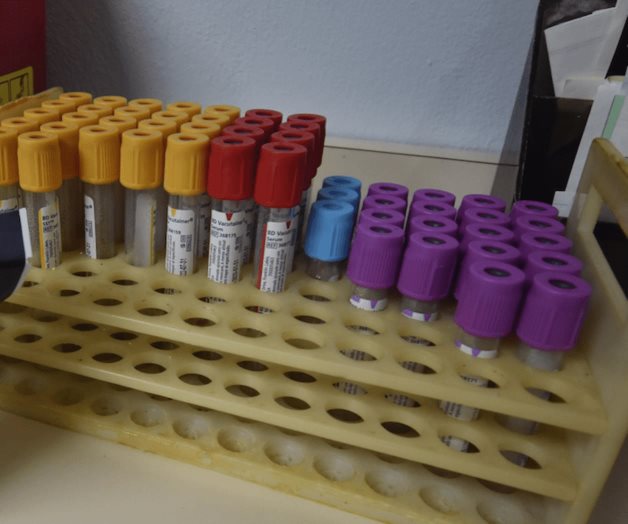 Bajo lupa casos positivos de antidoping; analizan despidos de funcionarios