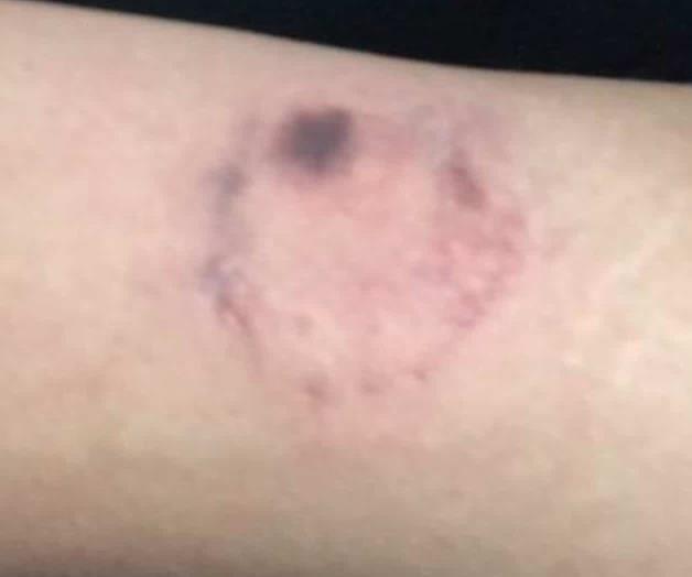 Hombre muerde a empleado de Central de Autobuses, en Monterrey