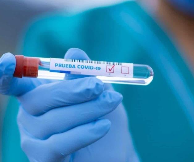 Aumentan solicitudes de pruebas Covid-19