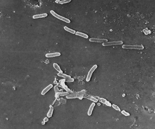 Superbacterias causan más de 1,2 millones de muertes Superbacterias causan más de 1,2 millones de muertes