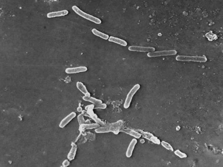 Superbacterias causan más de 1,2 millones de muertes Superbacterias causan más de 1,2 millones de muertes