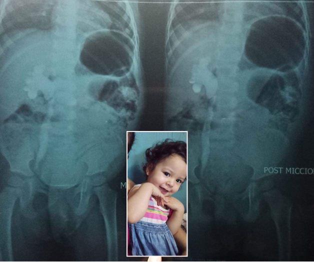 Urge familia apoyo: financiar operación. ¡Apoyemos a Emily!