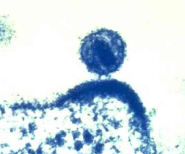 Identifican variante más virulenta del VIH
