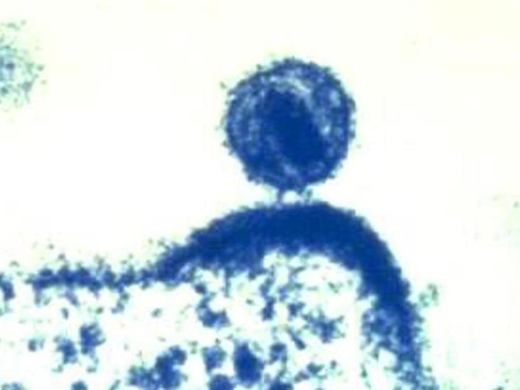 Identifican variante más virulenta del VIH Identifican variante más virulenta del VIH