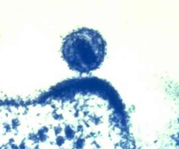 Identifican variante VIH más virulenta Identifican variante VIH más virulenta