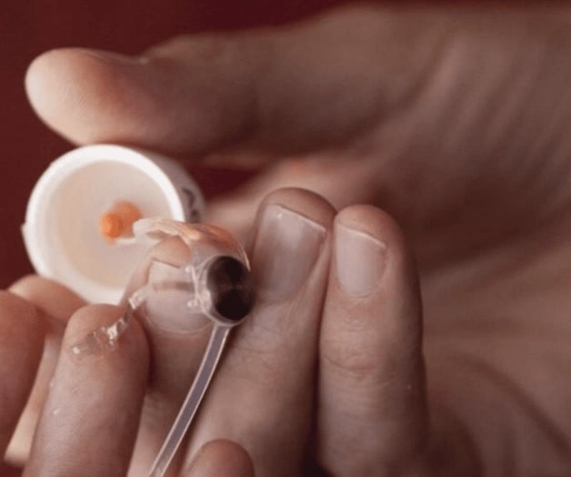 Los ojos biónicos de más de 350 personas quedan obsoletos tras quiebra de empresa