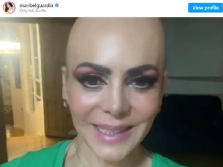 Maribel Guardia sorprende a fans tras aparecer calva Maribel Guardia sorprende a fans tras aparecer calva
