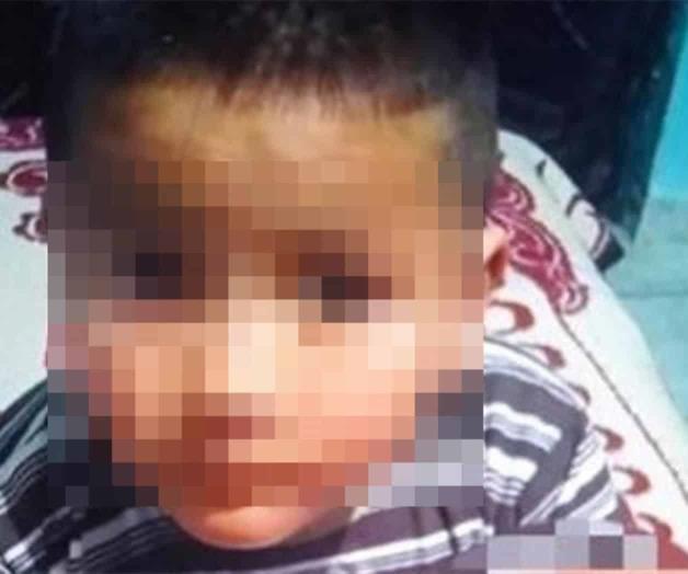 Acusan a padrastro de calcinar a su hijo de 7 años
