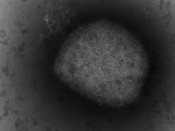 Detectan 2 cepas de viruela símica en EU Detectan 2 cepas de viruela símica en EU
