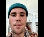 Justin Bieber cancela los próximos conciertos por una parálisis facial provocada por un virus