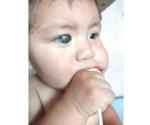 Bebé de 11 meses requiere cuarta cirugía en el ojo