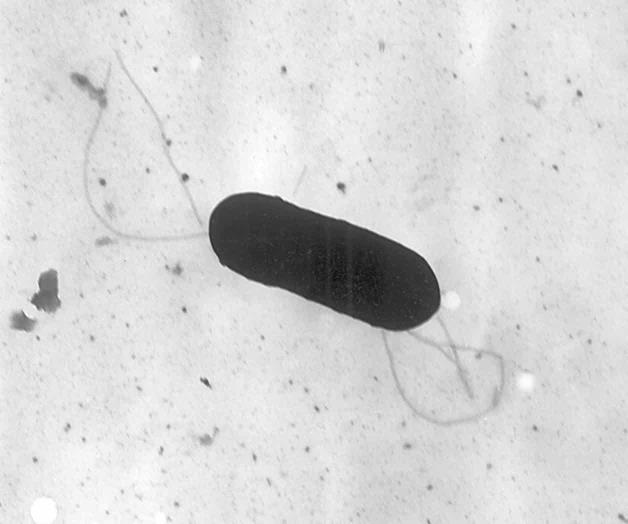 Brote de listeriosis es vinculado a una muerte Brote de listeriosis es vinculado a una muerte