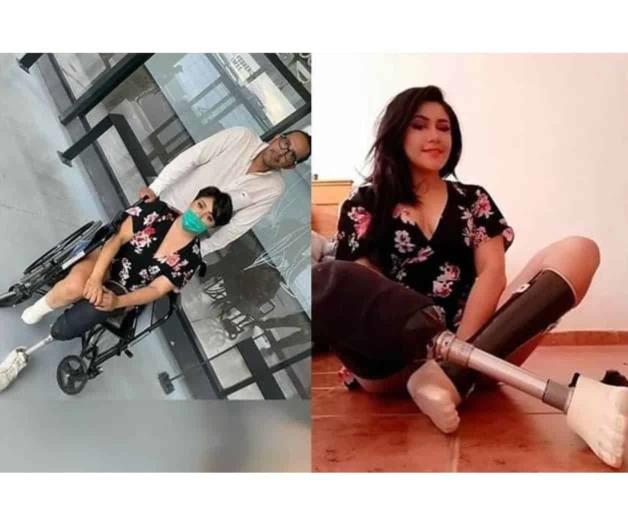 La negligencia del IMSS que causó amputación a Vanessa