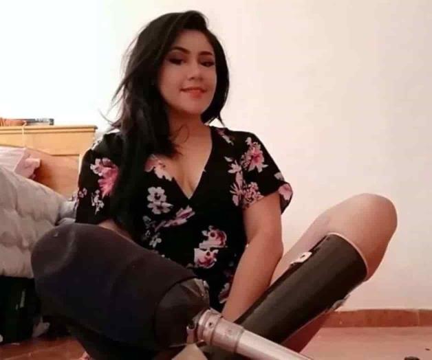 Compensará IMSS a Vanessa tras denuncia por amputación Compensará IMSS a Vanessa tras denuncia por amputación