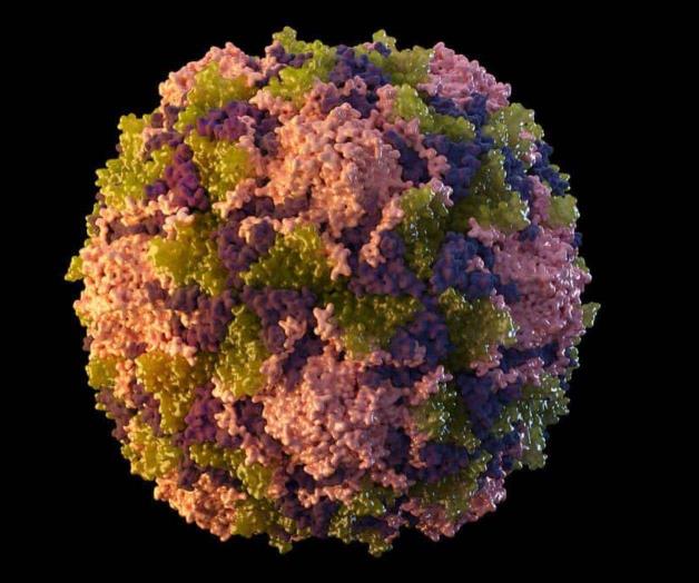 NY reporta caso de polio; el primero en EEUU en una década