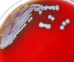 Detectan en EEUU bacteria que causa melioidosis