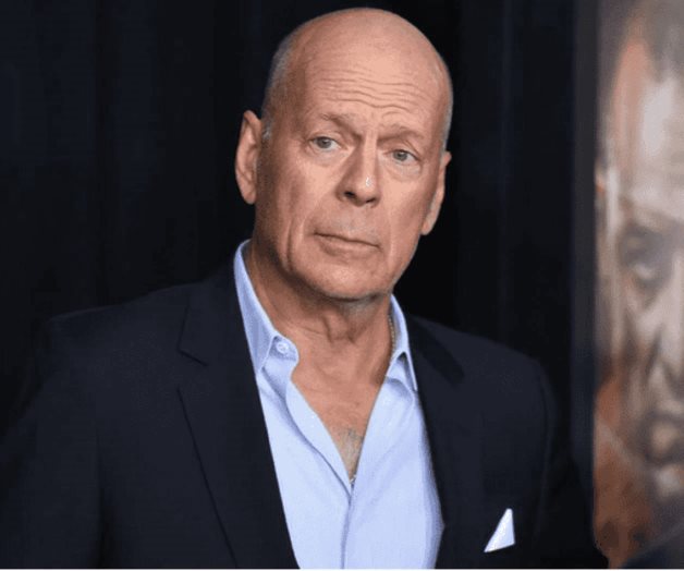 Pérdida de las palabras: el terrible efecto de la afasia