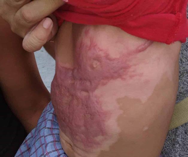 Fundación Michou y Mau ha salvado vidas infantiles Fundación Michou y Mau ha salvado vidas infantiles