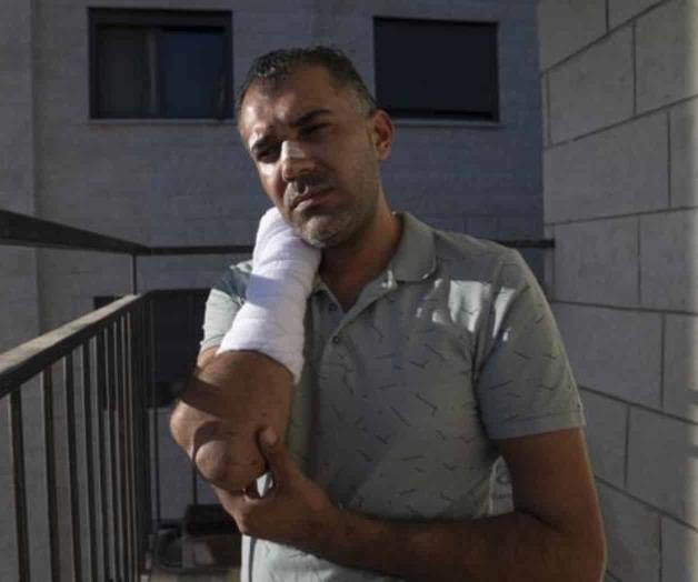 Palestino denuncia haber sido golpeado por policía israelí