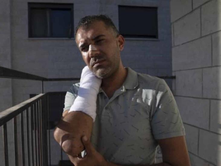 Palestino denuncia haber sido golpeado por policía israelí Palestino denuncia haber sido golpeado por policía israelí