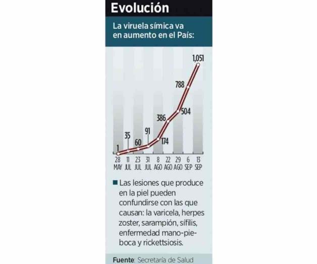 Embiste la viruela del mono