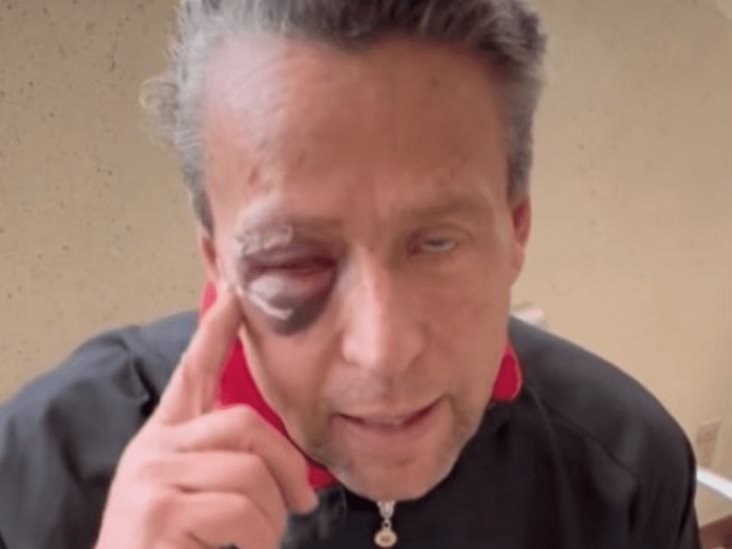 “Soy víctima colateral de un asunto muy delicado”, dice Alfredo Adame en un video “Soy víctima colateral de un asunto muy delicado”, dice Alfredo Adame en un video