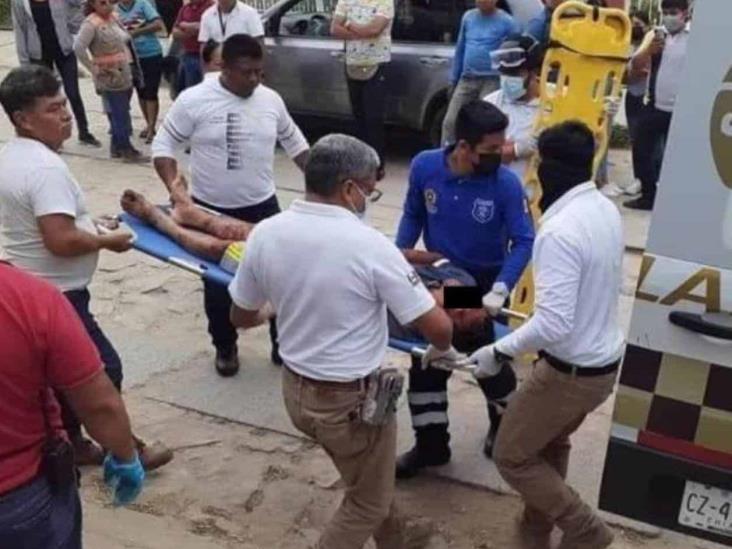 Pitbull casi le arranca el brazo a presunto ladrón en Chiapas Pitbull casi le arranca el brazo a presunto ladrón en Chiapas