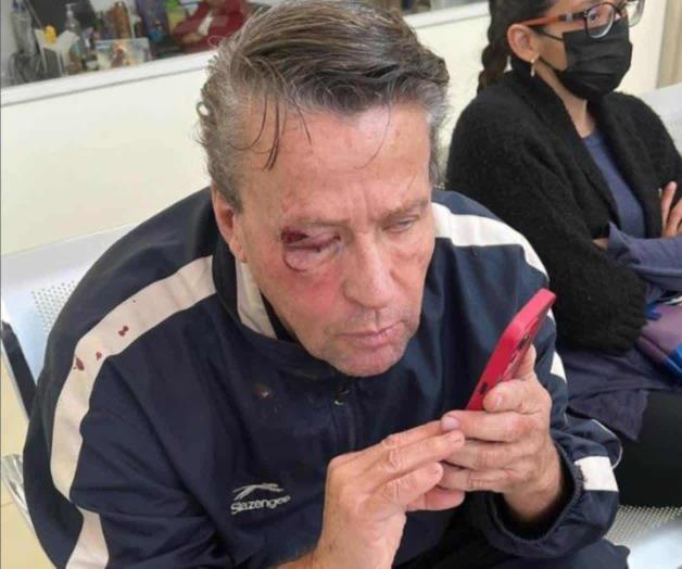 Operan a Alfredo Adame por lesiones en el rostro