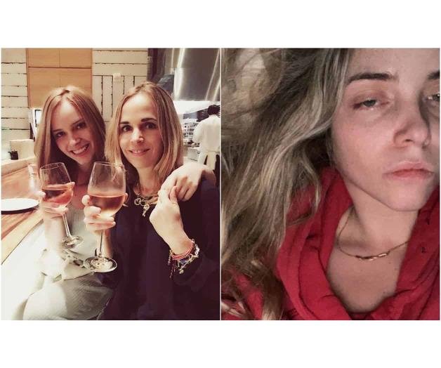 Por duelo va a psiquiátrico Por duelo va a psiquiátrico