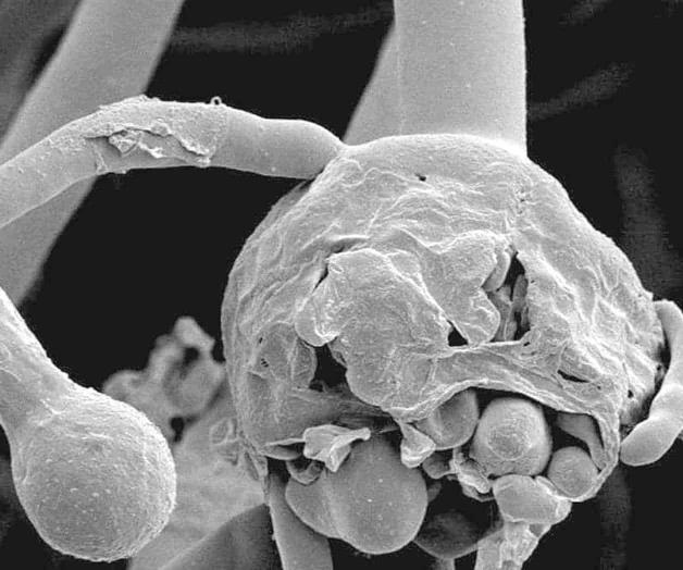 Ataca hongo negro...ahora en Tamaulipas