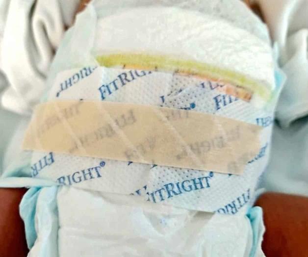 Acusan falta de pañales para bebés en el ISSSTE Acusan falta de pañales para bebés en el ISSSTE