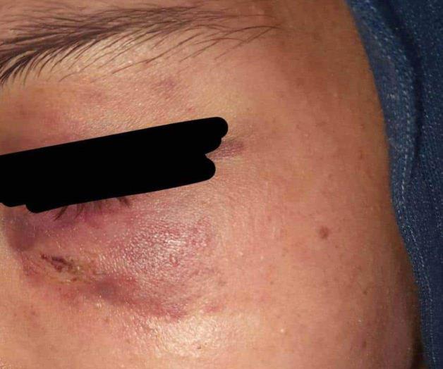 Agreden a golpes a un  alumno de secundaria