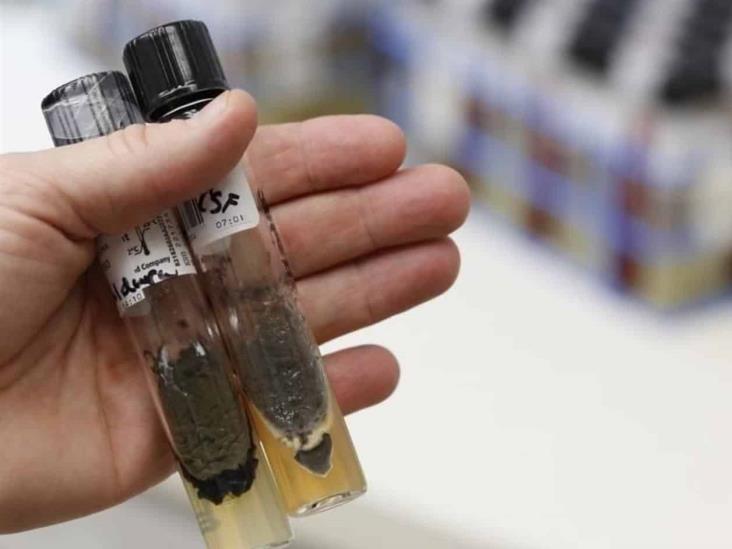 Mueren 2 personas por meningitis en Durango Mueren 2 personas por meningitis en Durango