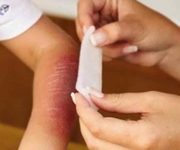 Cuetes dejan 4 niños quemados