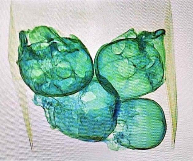 Detectan paquete con 4 cráneos en aeropuerto de Querétaro Detectan paquete con 4 cráneos en aeropuerto de Querétaro