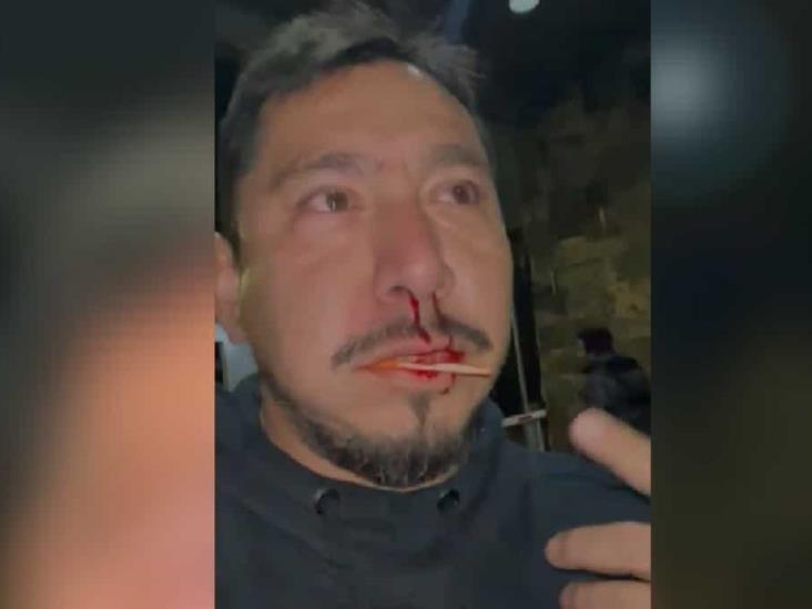 Policía de Jalisco golpea a ciudadano Policía de Jalisco golpea a ciudadano