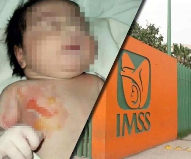 Denuncian a clínica del IMSS en Durango por quemar a bebé