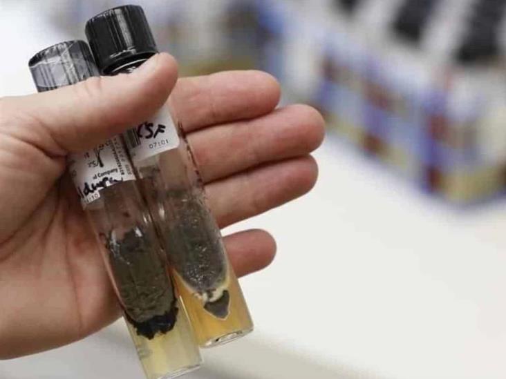 Suman 35 decesos por meningitis en Durango Suman 35 decesos por meningitis en Durango