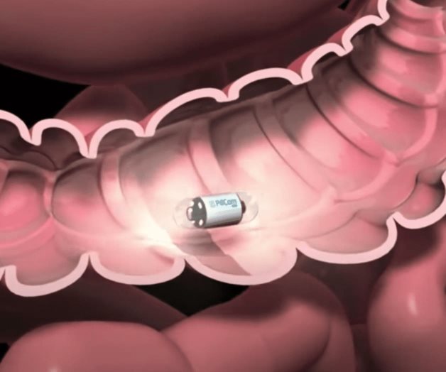 Nanobots, los pequeños robots capaces de detectar células enfermas Nanobots, los pequeños robots capaces de detectar células enfermas